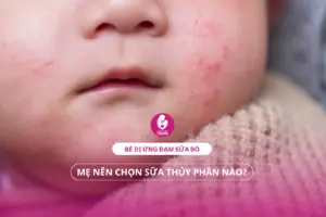 Bé dị ứng đạm sữa bò: Mẹ nên chọn sữa thủy phân nào?
