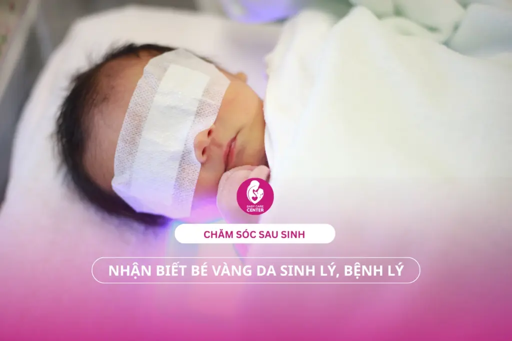 Chăm sóc sau sinh: Nhận biết trẻ vàng da sinh lý, bệnh lý.