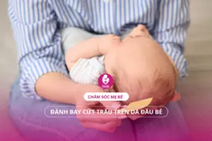Mẹo chăm sóc mẹ bé: Đánh bay cứt trâu trên da đầu bé