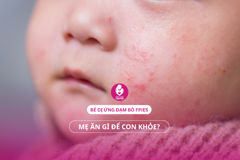 Chăm sóc mẹ bé dị ứng đạm bò FPIES: Mẹ ăn gì để con khỏe?