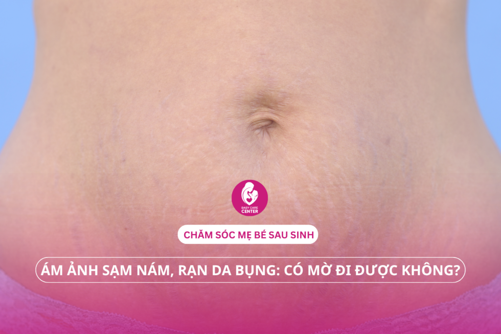 Chăm sóc sau sinh: Mẹo đánh bay sạm nám, rạn da bụng